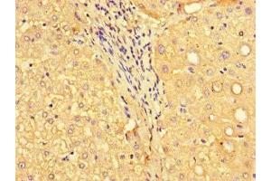 Immunohistochemistry of paraffin-embedded human liver tissue using ABIN7160576 at dilution of 1:100
