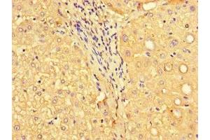 Immunohistochemistry of paraffin-embedded human liver tissue using ABIN7160576 at dilution of 1:100 (MYH3 anticorps  (AA 1-217))