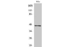 Western Blotting (WB) image for anti-Acyl-CoA Thioesterase 4 (ACOT4) (C-Term) antibody (ABIN3183149) (ACOT4 anticorps  (C-Term))