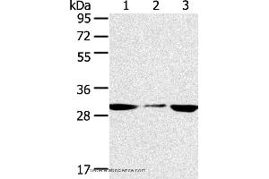 Western blot analysis of PC3 and hepg2 cell, human fetal liver tissue, using SDHB Polyclonal Antibody at dilution of 1:400 (SDHB anticorps)
