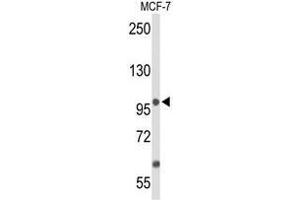 Western blot analysis of ANO7 Antibody (N-term) in MCF-7 cell line lysates (35µg/lane). (Anoctamin 7 anticorps  (N-Term))