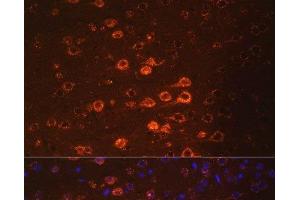 Immunofluorescence analysis of Mouse brain using NEFM Polyclonal Antibody at dilution of 1:100. (NEFM anticorps)