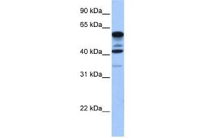 WB Suggested Anti-FAM46C Antibody Titration: 0. (FAM46C anticorps  (Middle Region))
