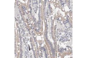 Immunohistochemical staining of human duodenum with NT5DC1 polyclonal antibody  shows moderate cytoplasmic positivity in glandular cells. (NT5DC1 anticorps)