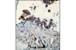 FCN3 Antibody (C-term) (ABIN656492 and ABIN2845769) immunohistochemistry analysis in formalin fixed and paraffin embedded human lung tissue followed by peroxidase conjugation of the secondary antibody and DAB staining.