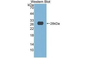 Detection of Recombinant DNASE1, Human using Monoclonal Antibody to Deoxyribonuclease I (DNASE1) (DNASE1 anticorps  (AA 19-259))