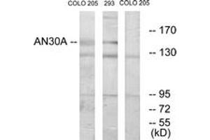 Western blot analysis of extracts from 293/COLO cells, using AN30A Antibody. (ANKRD30A anticorps  (AA 1041-1090))
