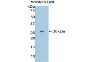 Western Blotting (WB) image for anti-Topoisomerase (DNA) II beta 180kDa (TOP2B) (AA 446-655) antibody (ABIN1860831)