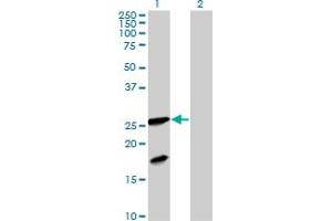 Western Blot analysis of FXN expression in transfected 293T cell line by FXN MaxPab polyclonal antibody. (Frataxin anticorps  (AA 1-210))