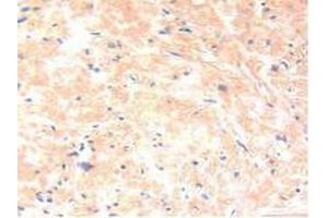 IHC-P analysis of Human Prostate Gland Tissue, with DAB staining. (IL-13 anticorps  (AA 25-146))