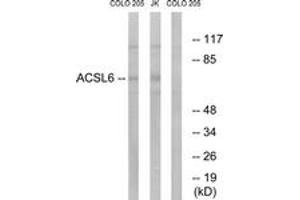 Western blot analysis of extracts from COLO/Jurkat cells, using ACSL6 Antibody. (ACSL6 anticorps  (AA 499-548))