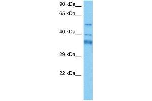 Host:  Mouse  Target Name:  GTF2H4  Sample Tissue:  Mouse Heart  Antibody Dilution:  1ug/ml