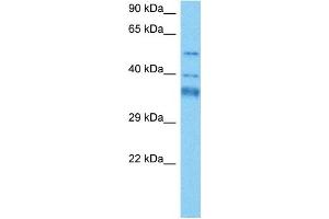 Host:  Mouse  Target Name:  GTF2H4  Sample Tissue:  Mouse Heart  Antibody Dilution:  1ug/ml (GTF2H4 anticorps  (N-Term))