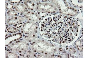 Image no. 1 for anti-tRNA Methyltransferase 2 Homolog A (TRMT2A) antibody (ABIN1501516)