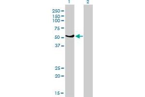 Western Blot analysis of GABPA expression in transfected 293T cell line by GABPA monoclonal antibody (M01), clone 4B8-G6.