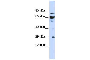 DCUN1D3 antibody used at 1 ug/ml to detect target protein. (DCUN1D3 anticorps)