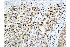 Immunohistochemistry (IHC) image for anti-Hepatitis B Virus Surface Antigen (HBsAg) antibody (ABIN723066) (HBSAg anticorps)