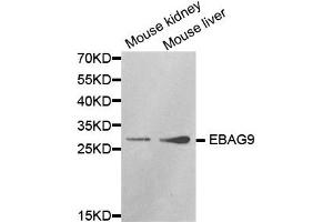 Western Blotting (WB) image for anti-Estrogen Receptor Binding Site Associated, Antigen, 9 (EBAG9) antibody (ABIN1872406) (RCAS1 anticorps)