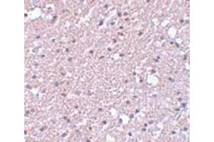 Immunohistochemistry (IHC) image for anti-Transmembrane Protein 184A (TMEM184A) (C-Term) antibody (ABIN1030750) (TMEM184A anticorps  (C-Term))