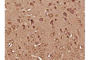 Paraformaldehyde-fixed, paraffin embedded mouse brain tissue, Antigen retrieval by boiling in sodium citrate buffer (pH6. (CAMK2B anticorps  (AA 1-100))