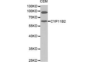 Western Blotting (WB) image for anti-Cytochrome P450, Family 11, Subfamily B, Polypeptide 2 (CYP11B2) (AA 234-503) antibody (ABIN1679468) (CYP11B2 anticorps  (AA 234-503))