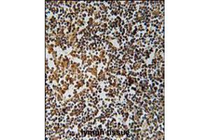 PYHIN1 Antibody immunohistochemistry analysis in formalin fixed and paraffin embedded human lymph tissue followed by peroxidase conjugation of the secondary antibody and DAB staining. (PYHIN1 anticorps  (N-Term))