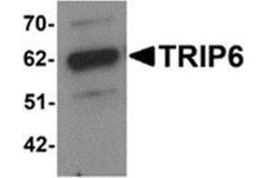 Western blot analysis of TRIP6 in EL4 cell lysate with TRIP6 antibody at 1 μg/ml. (TRIP6 anticorps  (Center))