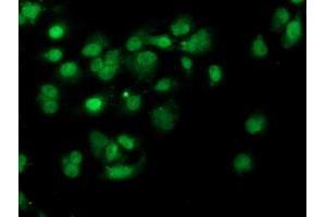 Anti-PDSS2 mouse monoclonal antibody (ABIN2455333) immunofluorescent staining of COS7 cells transiently transfected by pCMV6-ENTRY PDSS2 (RC207892). (PDSS2 anticorps)