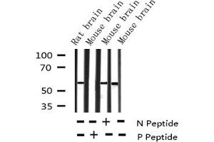 Western blot analysis of Phospho-Tyrosine Hydroxylase (Ser40) expression in various lysates