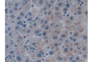Detection of HO1 in Human Liver Tissue using Polyclonal Antibody to Heme Oxygenase 1 (HO1)