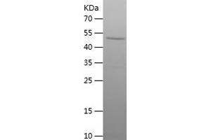 Western Blotting (WB) image for ERBB Receptor Feedback Inhibitor 1 (ERRFI1) (AA 224-462) protein (His-IF2DI Tag) (ABIN7122811)