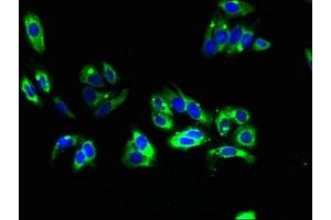 Immunofluorescent analysis of HepG2 cells using ABIN7173199 at dilution of 1:100 and Alexa Fluor 488-congugated AffiniPure Goat Anti-Rabbit IgG(H+L) (TMEM31 anticorps  (AA 1-118))