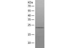 Western Blotting (WB) image for Malectin (MLEC) (AA 29-269) protein (His-IF2DI Tag) (ABIN7123838)