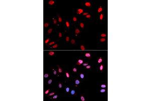 Immunofluorescence analysis of U2OS cells using Rad18 antibody (ABIN6128609, ABIN6146628, ABIN6146630 and ABIN6217430).
