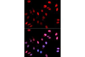 Immunofluorescence analysis of U2OS cells using Rad18 antibody (ABIN6128609, ABIN6146628, ABIN6146630 and ABIN6217430). (RAD18 anticorps  (AA 216-495))