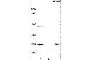 Formalin-fixed and paraffin embedded rat heart tissue labeled with Anti MYOG/MYOGENIN Polyclonal Antibody,Unconjugated (ABIN700660) at 1:200 followed by conjugation to the secondary antibody and DAB staining.