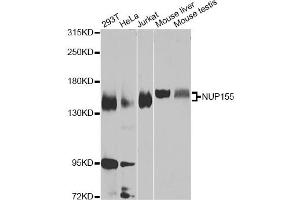 Western blot analysis of extracts of various cell lines, using NUP155 Antibody (ABIN5975637) at 1/1000 dilution. (NUP155 anticorps)