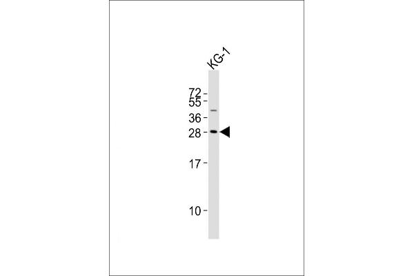 PYCRL anticorps  (AA 139-171)