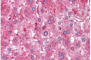 Human Liver (formalin-fixed, paraffin-embedded) stained with ATM antibody ABIN213900 at 1-2 ug/ml followed by biotinylated goat anti-rabbit IgG secondary antibody ABIN481713, alkaline phosphatase-streptavidin and chromogen. (ATM anticorps  (C-Term))