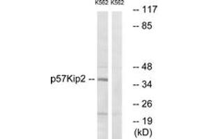 Western blot analysis of extracts from K562 cells, using p57 Kip2 (Ab-310) Antibody. (CDKN1C anticorps  (AA 267-316))