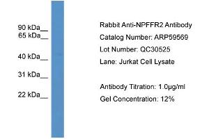 WB Suggested Anti-NPFFR2  Antibody Titration: 0. (NPFFR2 anticorps  (Middle Region))