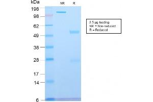 SDS-PAGE Analysis Purified Spectrin beta III Rabbit Recombinant Monoclonal (SPTBN2/2894R).