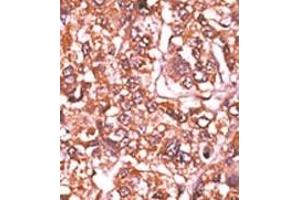 Image no. 2 for anti-Retinoblastoma 1 (RB1) (pSer612) antibody (ABIN358212) (Retinoblastoma 1 anticorps  (pSer612))