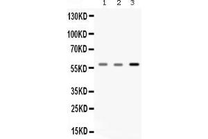 Western blot analysis of Catalase expression in rat skeletal muscle extract ( Lane 1), mouse skeletal muscle extract ( Lane 2) and A549 whole cell lysates ( Lane 3). (Catalase anticorps  (AA 344-527))