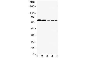 Western blot testing of SGLT1 antibody and Lane 1:  rat kidney;  2: (r) heart;  3: human HeLa;  4: (h) SW620;  5: (h) COLO320 cell lysate.