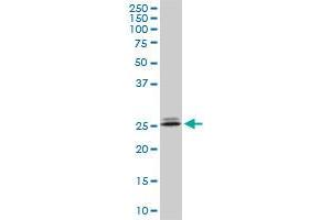 PHOSPHO1 monoclonal antibody (M10A), clone 1A11. (PHOSPHO1 anticorps  (AA 168-266))