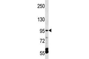 TRPV5 antibody western blot analysis in HepG2 lysate. (TRPV5 anticorps  (AA 634-663))