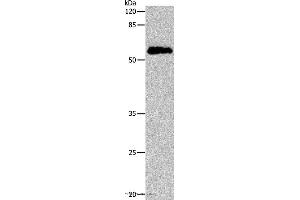 Western blot analysis of Human cervical cancer tissue, using CDC20 Polyclonal Antibody at dilution of 1:600 (CDC20 anticorps)