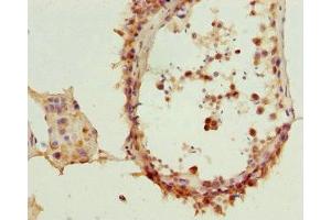 Immunohistochemistry of paraffin-embedded human testis tissue using ABIN7172454 at dilution of 1:100
