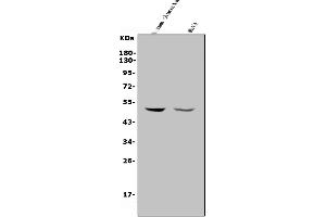 Western blot analysis of MMP28 using anti-MMP28 antibody (ABIN7599865).